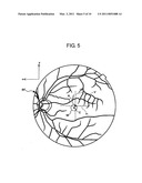 FUNDUS OCULI OBSERVING DEVICE diagram and image