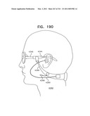 Biologically fit wearable electronics apparatus and methods diagram and image