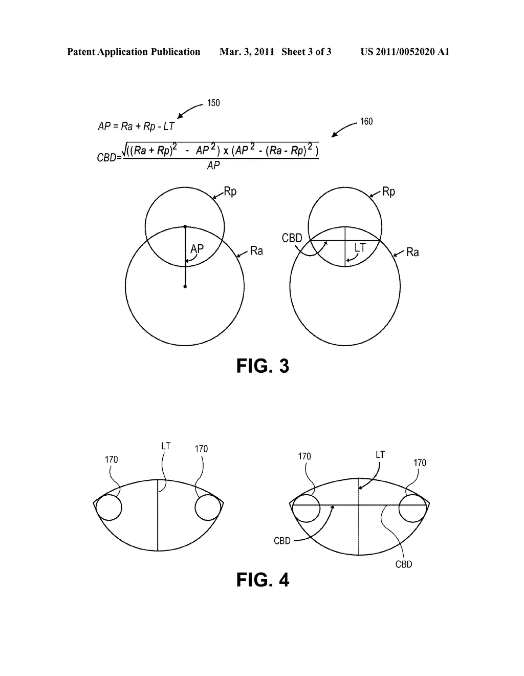 Lens Capsule Size Estimation - diagram, schematic, and image 04