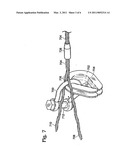 Thimble with element retaining feature diagram and image