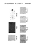 Identification and Characterization of a Specific CCK-C Receptor Antibody for Human Pancreatic Cancer and Its Use for Early Detection and Staging of Pancreatic Cancer diagram and image