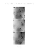 NEAR INFRA-RED PULSED LASER TRIGGERED DRUG RELEASE FROM HOLLOW NANOSHELL DISRUPTED VESICLES AND VESOSOMES diagram and image