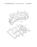 Formable Tray diagram and image