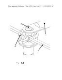 ORTHODONTIC ANCHORING SCREW diagram and image