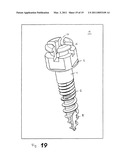 ORTHODONTIC ANCHORING SCREW diagram and image