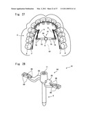 HUMAN BODY IMPLANT STRUCTURE, METHOD OF ASSEMBLING THE STRUCTURE AND METHOD OF DISASSEMBLING THE STRUCTURE diagram and image