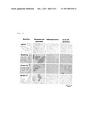 SMALL CELL LUNG CARCINOMA BIOMARKER PANEL diagram and image
