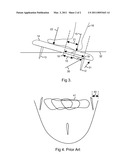 System for Fin Placement on Surfboards diagram and image