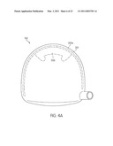 Golf Clubs and Golf Club Heads Having a Movable Weight diagram and image