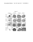 N-TERMINAL FGF VARIANTS HAVING INCREASED RECEPTOR SELECTIVITY AND USES THEREOF diagram and image