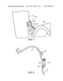 APPARATUS AND METHOD FOR RETRACTION OF TISSUE diagram and image