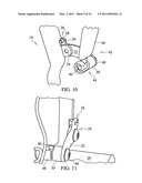 APPARATUS AND METHOD FOR RETRACTION OF TISSUE diagram and image