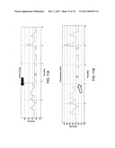 DIAGNOSIS OF PERIODIC BREATHING diagram and image