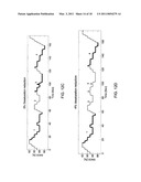 DIAGNOSIS OF PERIODIC BREATHING diagram and image