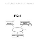 MEDICAL IMAGE DIAGNOSTIC APPARATUS AND METHOD USING A LIVER FUNCTION ANGIOGRAPHIC IMAGE, AND COMPUTER READABLE RECORDING MEDIUM ON WHICH IS RECORDED A PROGRAM THEREFOR diagram and image