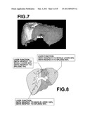 MEDICAL IMAGE DIAGNOSTIC APPARATUS AND METHOD USING A LIVER FUNCTION ANGIOGRAPHIC IMAGE, AND COMPUTER READABLE RECORDING MEDIUM ON WHICH IS RECORDED A PROGRAM THEREFOR diagram and image
