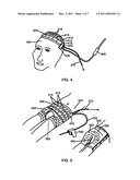 Apparatus for registering and tracking an instrument diagram and image