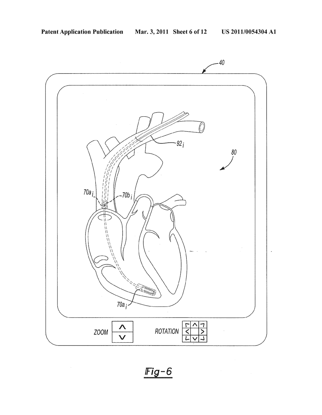 Combination Localization System - diagram, schematic, and image 07