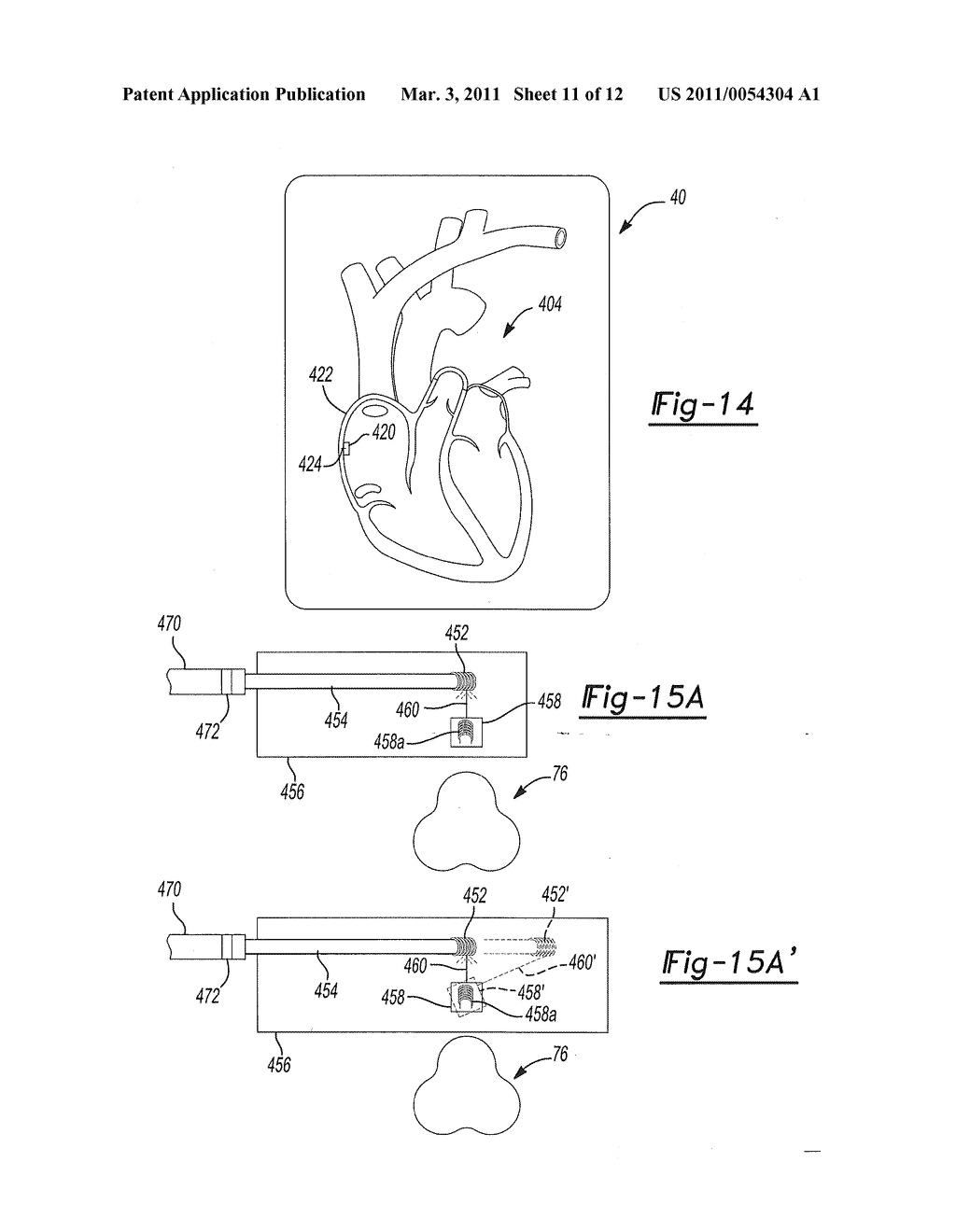 Combination Localization System - diagram, schematic, and image 12