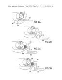 MICROMANIPULATOR CONTROL ARM FOR THERAPEUTIC AND IMAGING ULTRASOUND TRANSDUCERS diagram and image