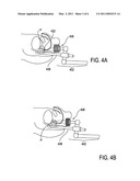 MICROMANIPULATOR CONTROL ARM FOR THERAPEUTIC AND IMAGING ULTRASOUND TRANSDUCERS diagram and image