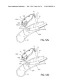 BILIARY SHUNTS, DELIVERY SYSTEMS, AND METHODS OF USING THE SAME diagram and image
