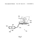 Oxygen Supply For Implantable Medical Device diagram and image