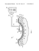 RE-EPITHELIALIZATION WOUND DRESSINGS AND SYSTEMS diagram and image