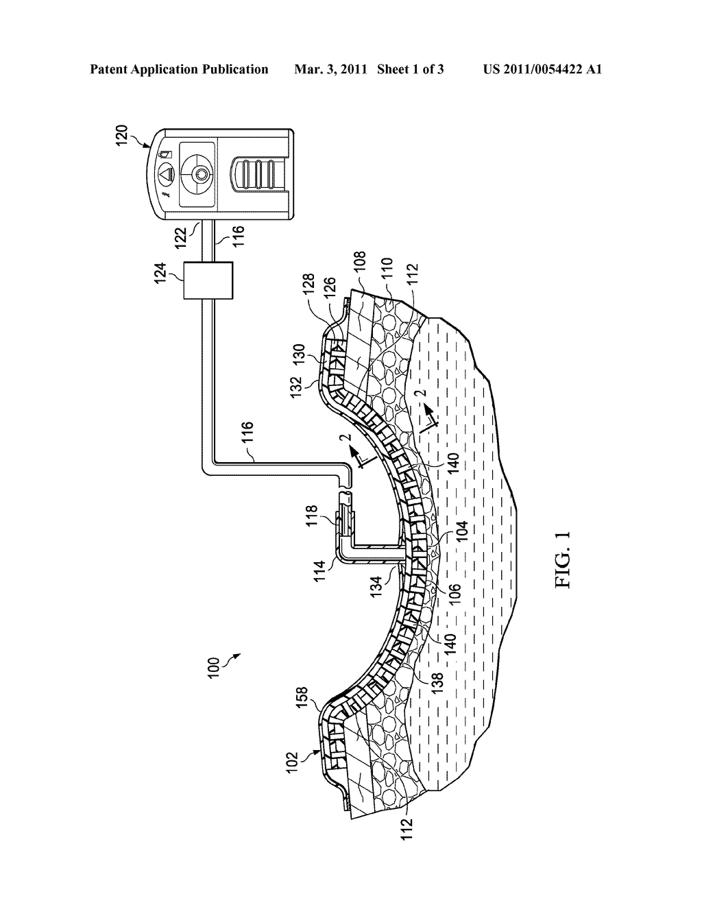 RE-EPITHELIALIZATION WOUND DRESSINGS AND SYSTEMS - diagram, schematic, and image 02