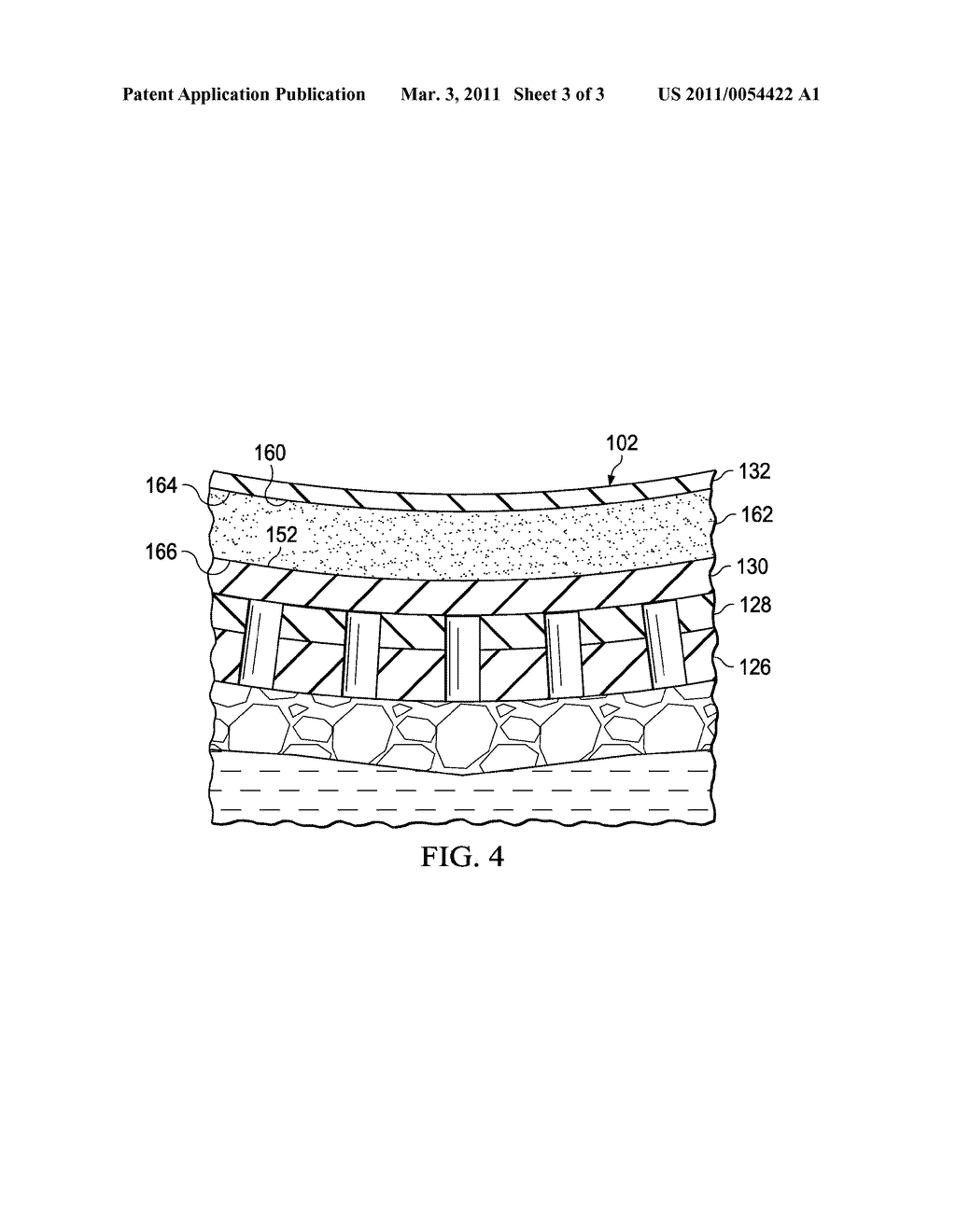 RE-EPITHELIALIZATION WOUND DRESSINGS AND SYSTEMS - diagram, schematic, and image 04