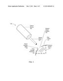 Devices and Methods for Treatment of Eye Disease diagram and image