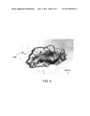 Devices and Methods for Treatment of Eye Disease diagram and image