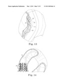 Paravalvular Leak Closure Devices and Methods diagram and image