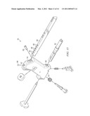 ANKLE ARTHRODESIS NAIL AND OUTRIGGER ASSEMBLY diagram and image