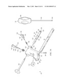 ANKLE ARTHRODESIS NAIL AND OUTRIGGER ASSEMBLY diagram and image