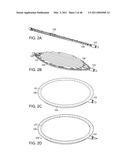 DEVICE AND METHOD FOR DEPLOYING AND ATTACHING AN IMPLANT TO A BIOLOGICAL TISSUE diagram and image