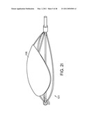 DEVICE AND METHOD FOR DEPLOYING AND ATTACHING AN IMPLANT TO A BIOLOGICAL TISSUE diagram and image