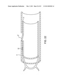 METHOD FOR CLOSING AN APERTURE IN A PATIENT S BODY diagram and image