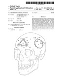 Craniotomy Closures and Plugs diagram and image