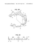 Craniotomy Closures and Plugs diagram and image