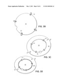 Craniotomy Closures and Plugs diagram and image