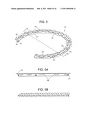 Craniotomy Closures and Plugs diagram and image