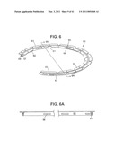 Craniotomy Closures and Plugs diagram and image