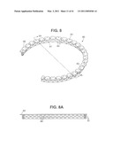 Craniotomy Closures and Plugs diagram and image