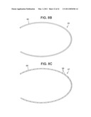 Craniotomy Closures and Plugs diagram and image