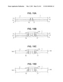 Craniotomy Closures and Plugs diagram and image