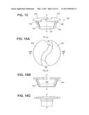 Craniotomy Closures and Plugs diagram and image