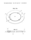 Craniotomy Closures and Plugs diagram and image