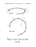 Craniotomy Closures and Plugs diagram and image