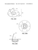 Craniotomy Closures and Plugs diagram and image